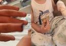 Criança tem parte do dedo amputada após mão ser prensada em armário escolar pela professora