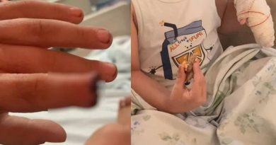 Criança tem parte do dedo amputada após mão ser prensada em armário escolar pela professora