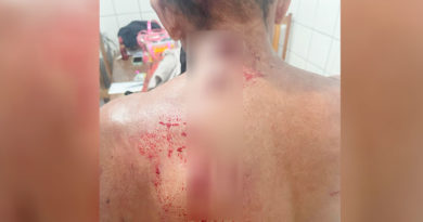 Santarém – Briga entre irmãos termina com um deles ferido com quatro golpes de faca