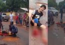 Santarém – Motociclista tem o pé amputado após atropelamento