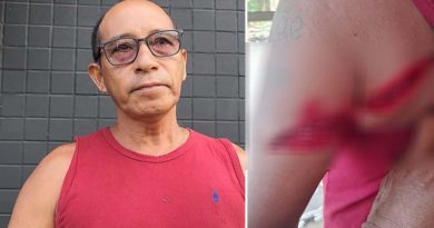 Homem é atacado a golpe de terçado na aldeia Atodi, região do rio Arapiuns