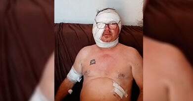 Homem é vítima de ataque de cachorro em Santarém